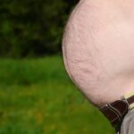 복부 지방분해주사 효과 알아보자
